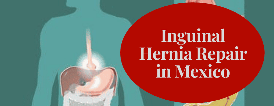 Inguinal Hernia Repair in Mexico
